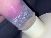 Sgorgo latte dal capezzolo